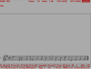 Score-input-rs.png